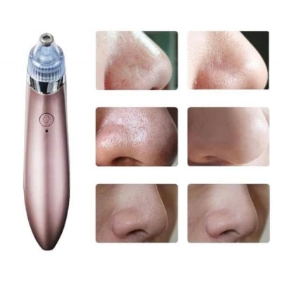 SİYAH NOKTA CİHAZI